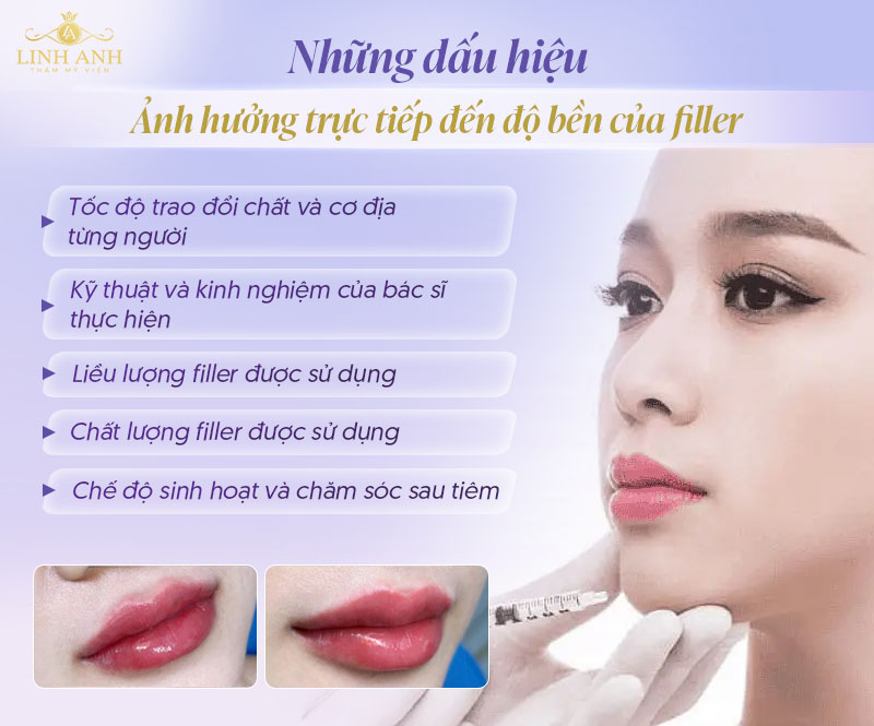 Tiêm filler giữ được bao lâu