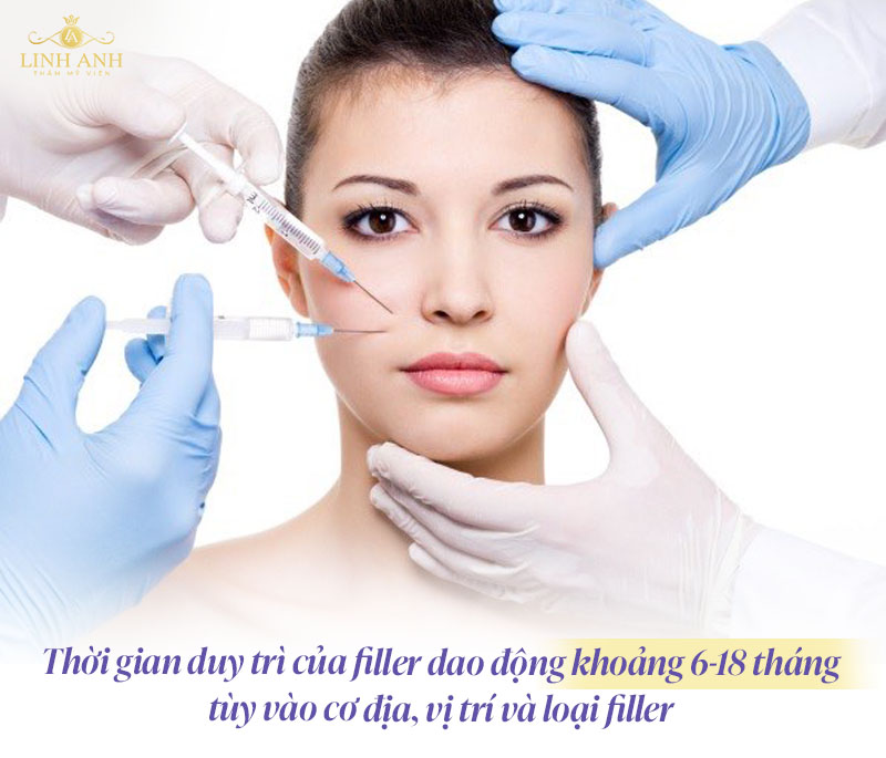 Tiêm filler giữ được bao lâu