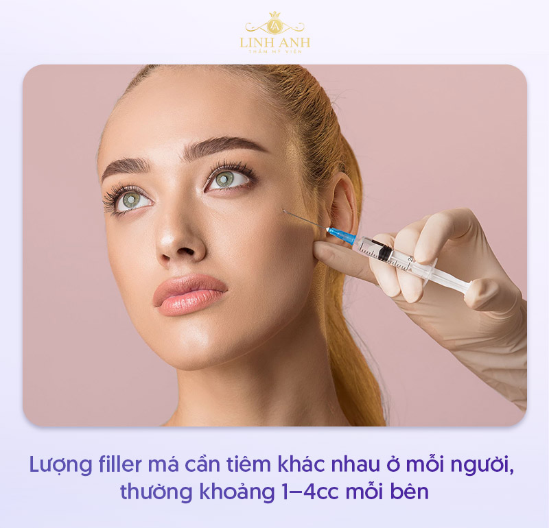 Tiêm filler má bao nhiêu cc là đủ