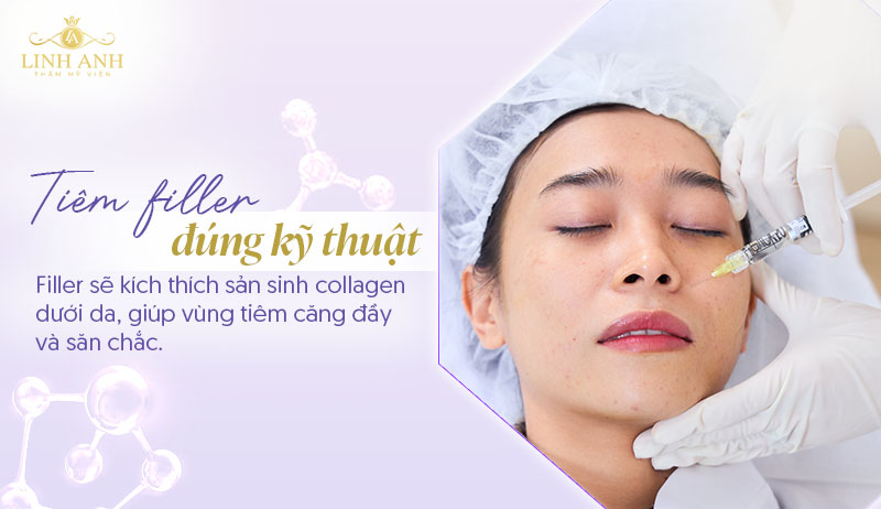 Tiêm filler má có bị chảy xệ không