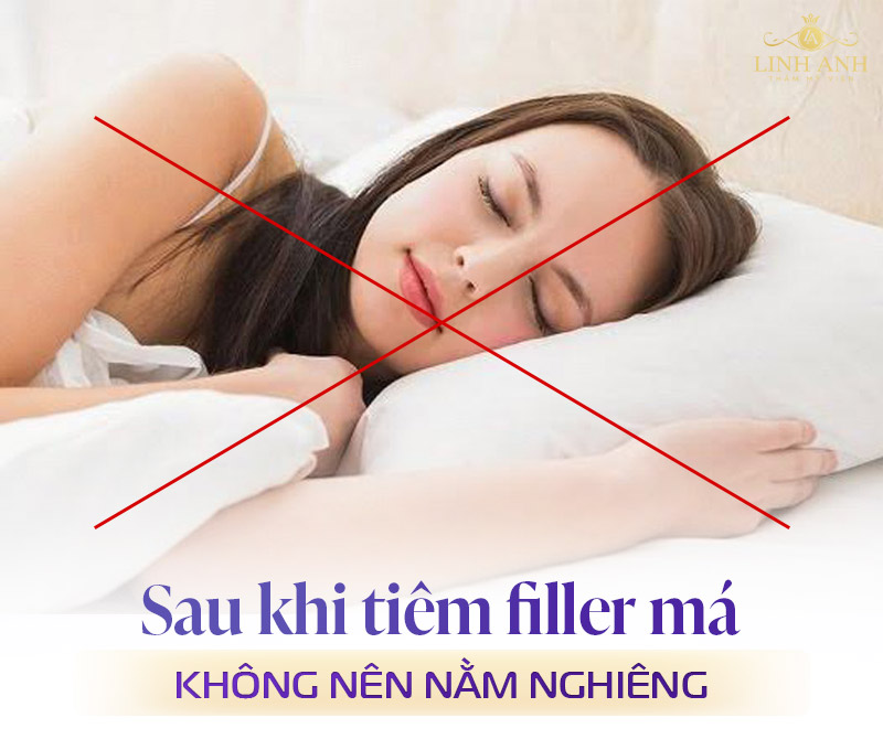Tiêm filler má có được nằm nghiêng không