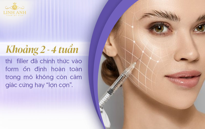 Tiêm filler môi bao lâu thì vào form Tiêm filler môi bao lâu thì vào form