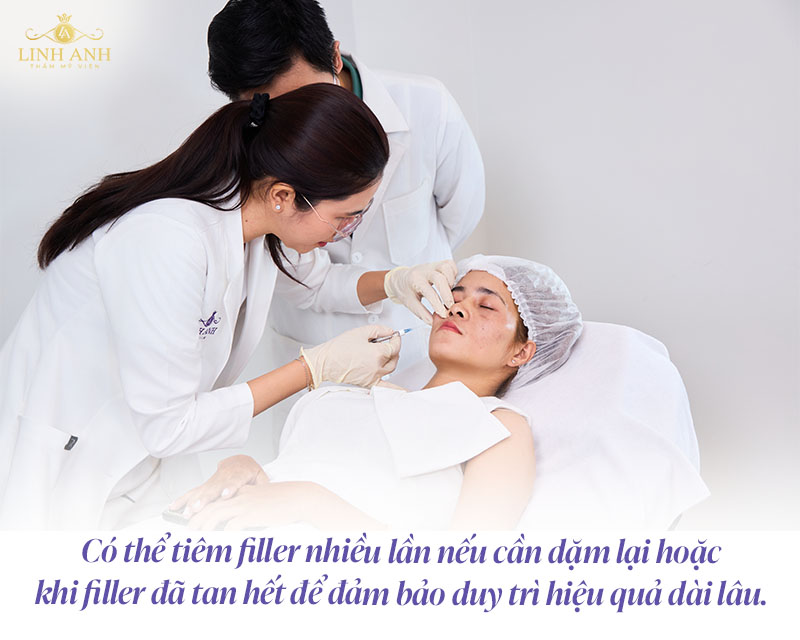 Tiêm filler nhiều lần có sao không