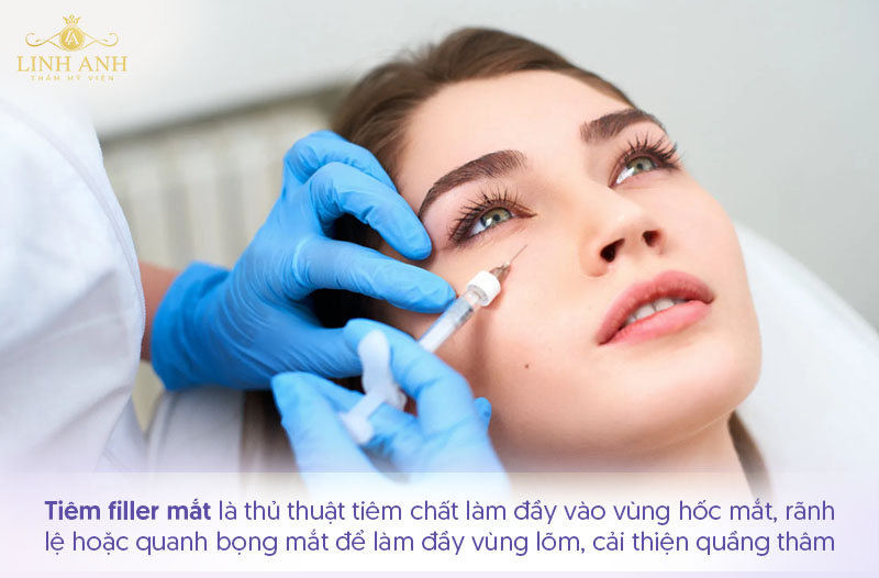 Tiêm filler vùng mắt Tiêm filler vùng mắt