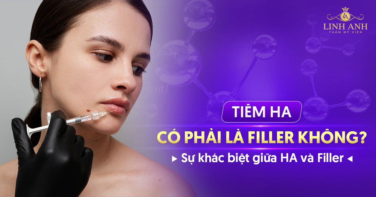 Tiêm HA có phải là filler không