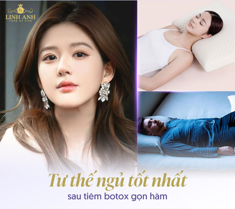 Tư thế ngủ đúng sau khi tiêm botox gọn hàm