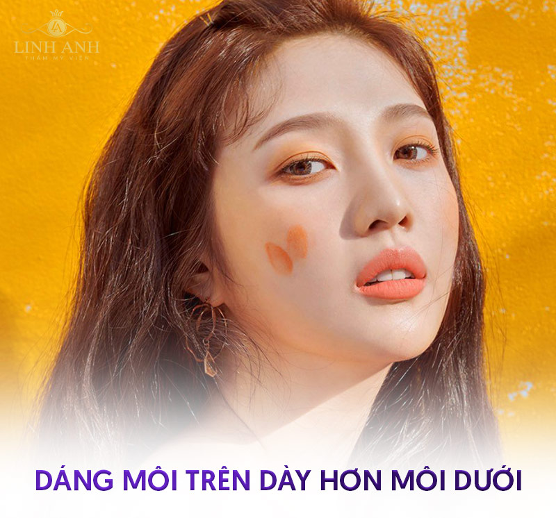 tướng môi dày