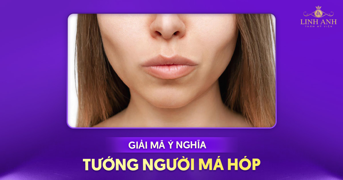 Tướng người má hóp: dấu hiệu và ý nghĩa nhân tướng học