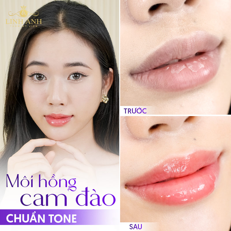 ưu điểm khi xăm môi màu hồng cam đào