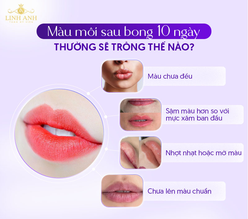 xăm môi sau bong 10 ngày