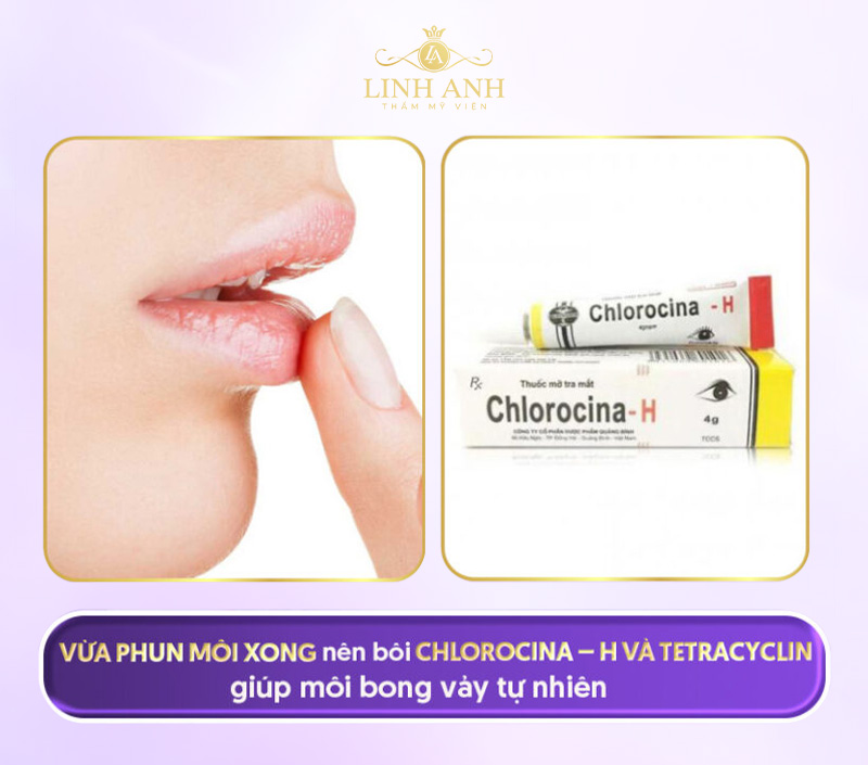 Xăm xong nên bôi thuốc gì