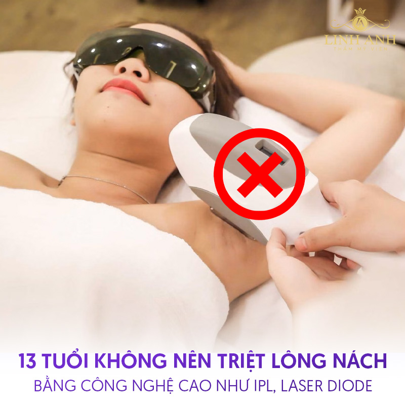 13 tuổi triệt lông nách được không