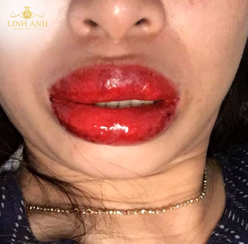 ảnh phun môi nịnh mắt ảnh phun môi nịnh mắt