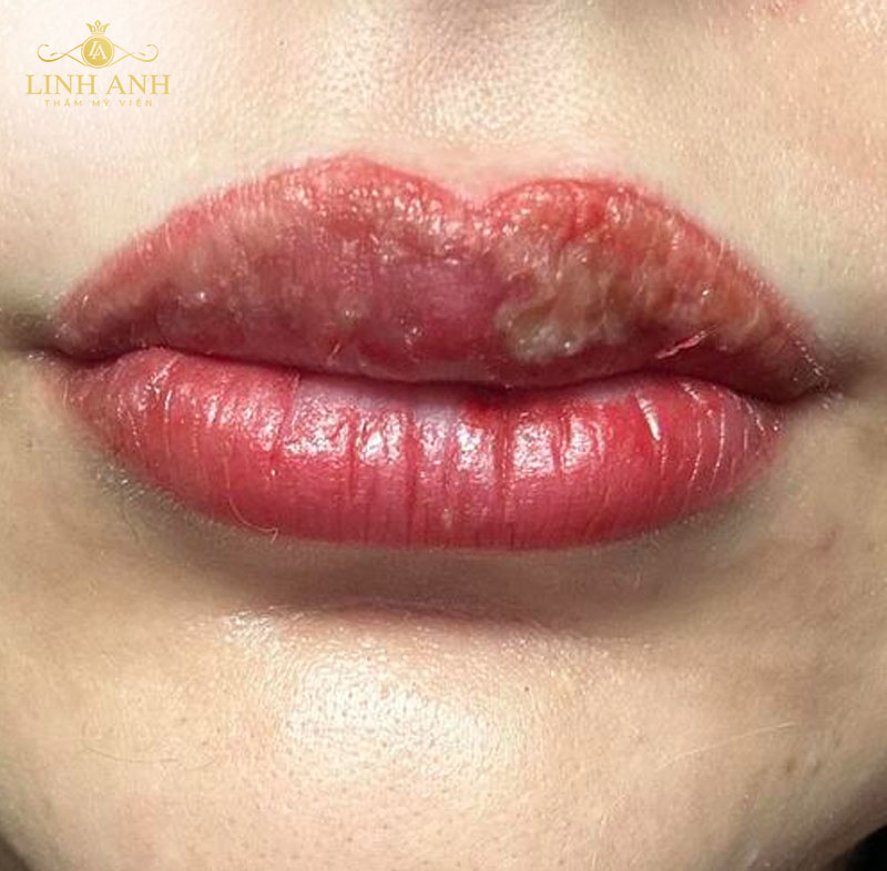 ảnh xăm môi nịnh mắt ảnh xăm môi nịnh mắt