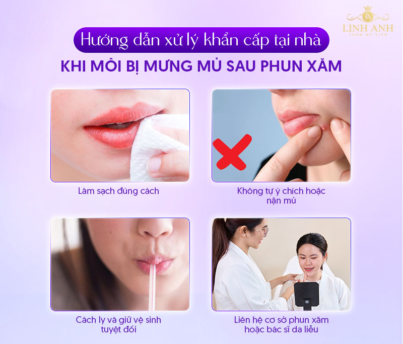 bôi thuốc gì nếu môi bị mưng mủ sau xăm