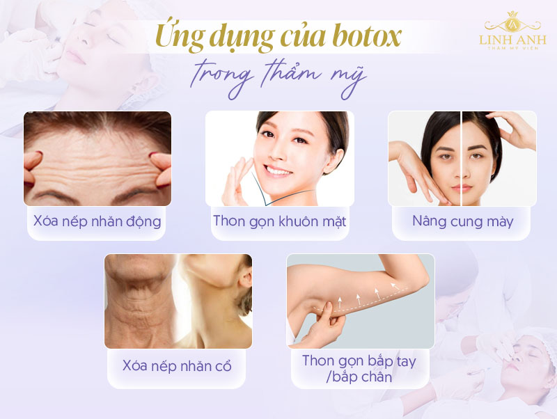 Botox Mỹ chính hãng