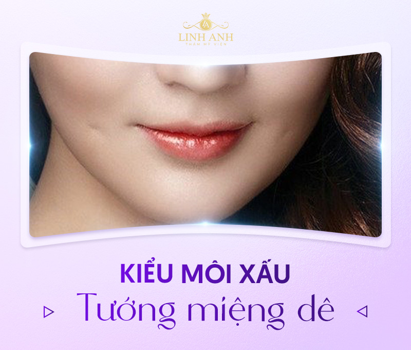 cách khắc phục dáng môi xấu cách khắc phục dáng môi xấu