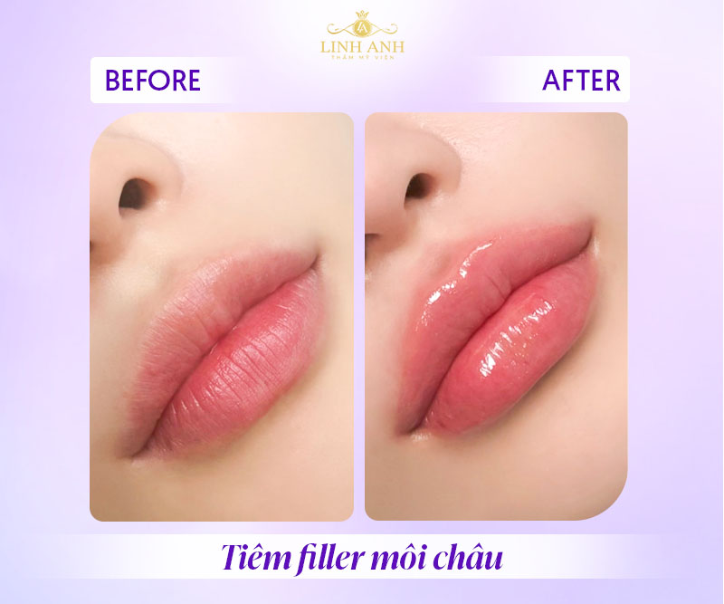 cách sở hữu môi châu cách sở hữu môi châu