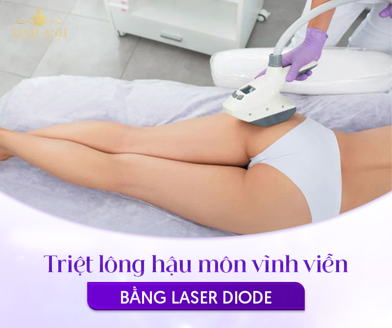 Cách triệt lông vùng hậu môn