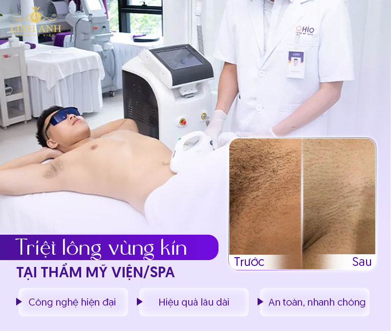 Cách triệt lông vùng kín nam giới
