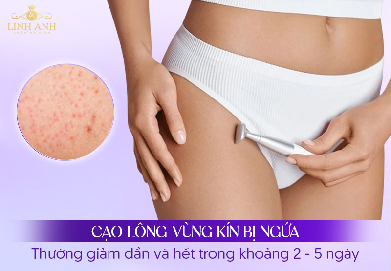 Cạo lông vùng kín bị ngứa bao lâu hết Cạo lông vùng kín bị ngứa bao lâu hết