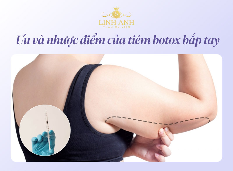 Có nên tiêm botox thon gọn bắp tay