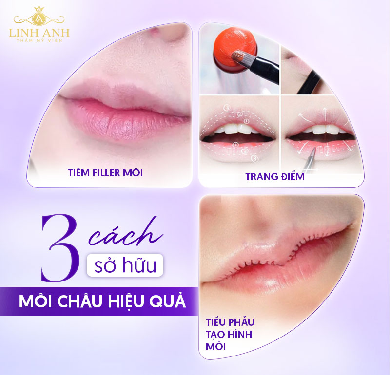 đặc điểm môi châu đặc điểm môi châu