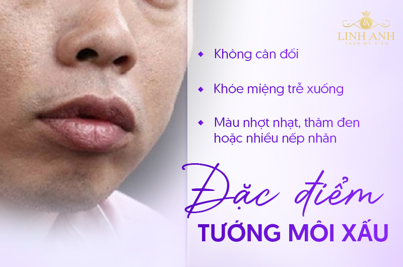 dáng môi xấu dáng môi xấu