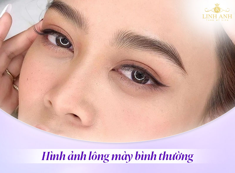 dấu hiệu nhận biết có thai qua chân mày dấu hiệu nhận biết có thai qua chân mày