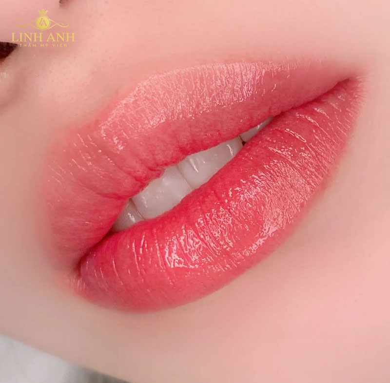 hình ảnh môi bong sau phun hình ảnh môi bong sau phun