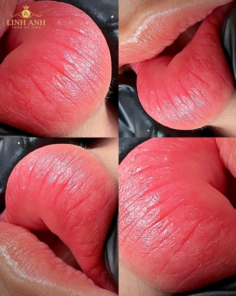 hình ảnh môi phun hình ảnh môi phun