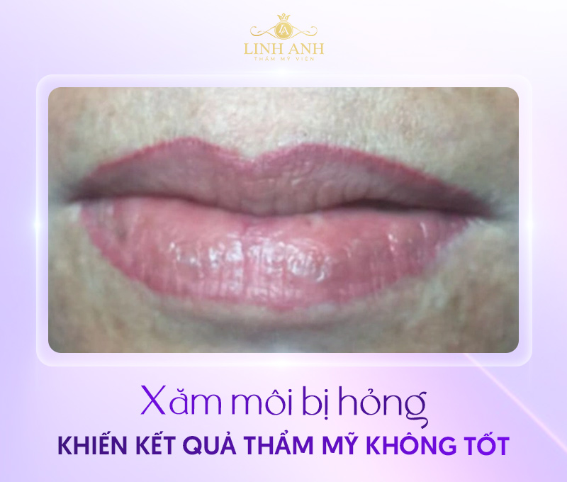 hình ảnh phun môi bị hỏng