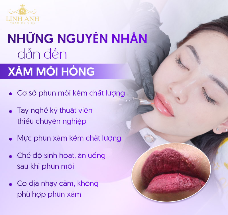 hình ảnh phun môi bị hư