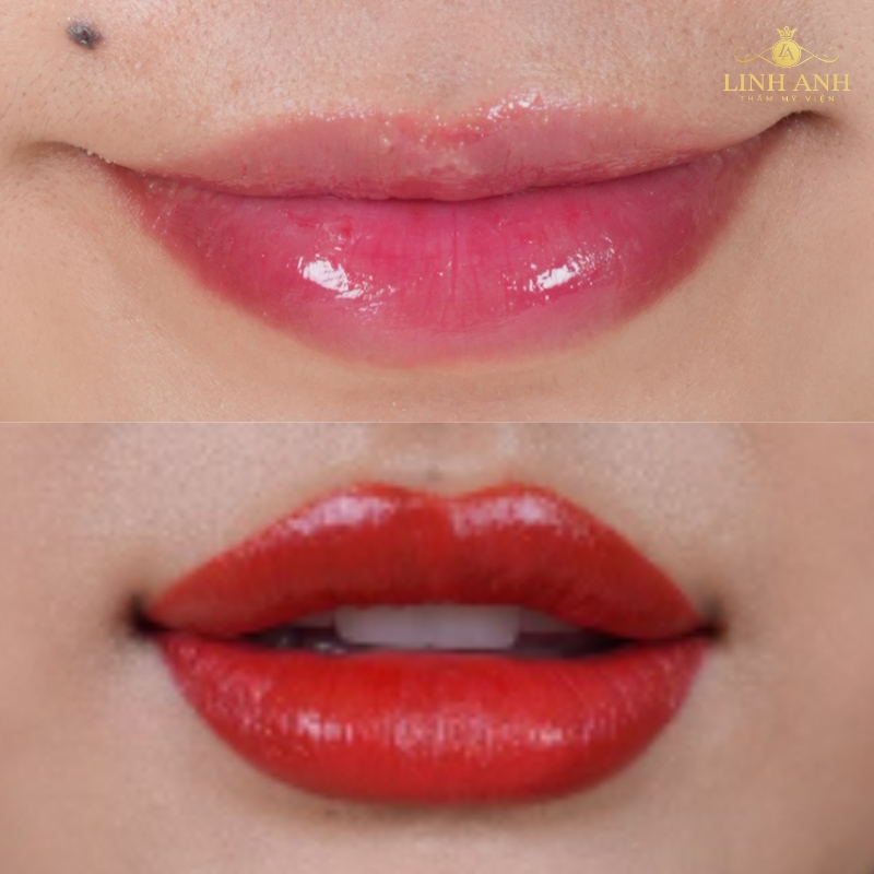 Hình ảnh phun môi đẹp