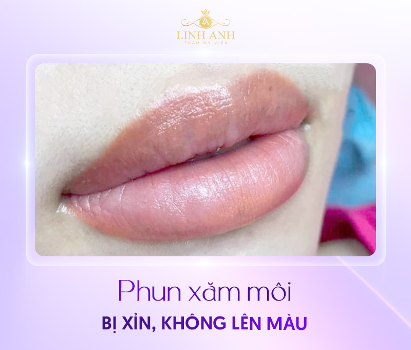 hình ảnh xăm môi bị hư