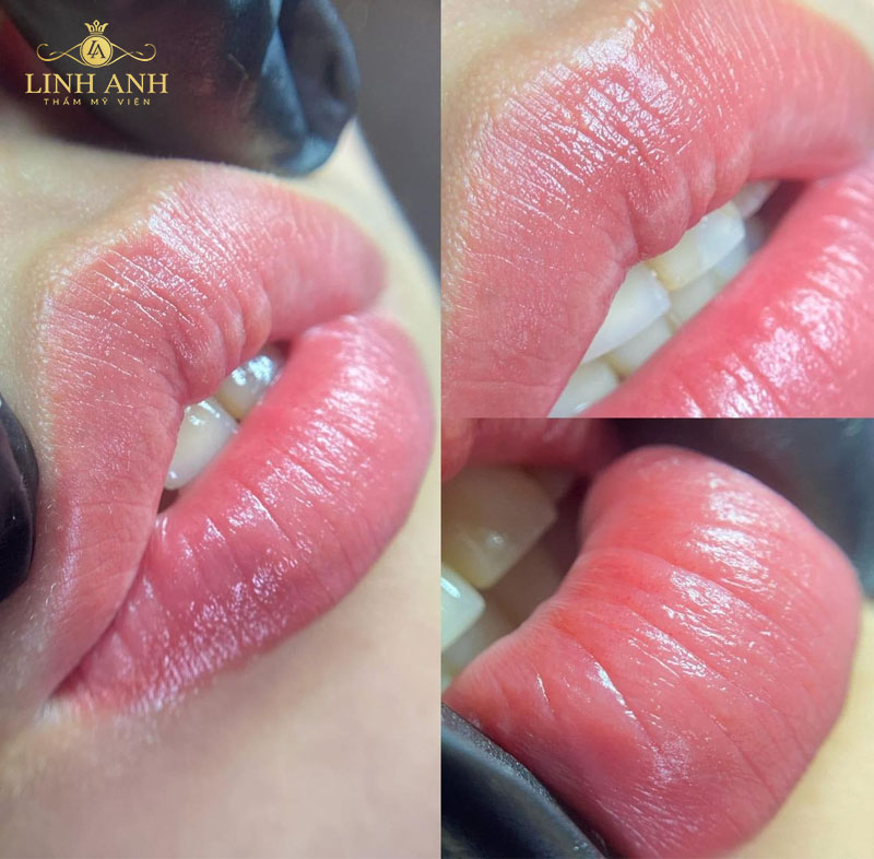 hình phun môi hình phun môi