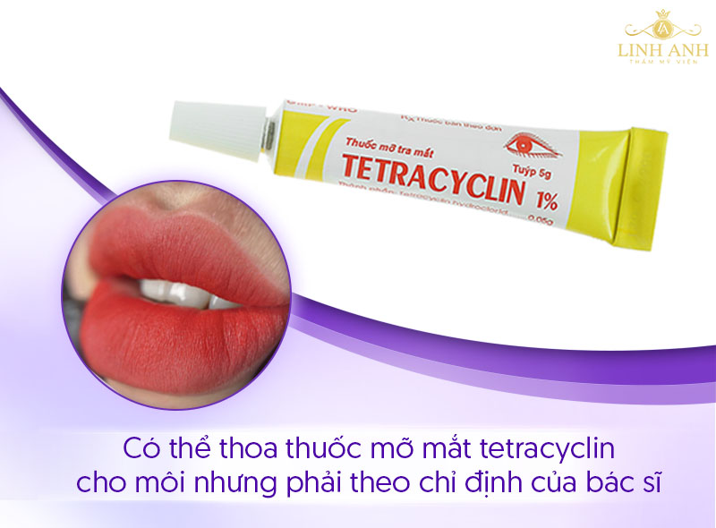 không nên tùy tiện bôi thuốc mỡ tra mắt lên môi