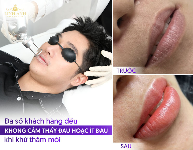 khử môi thâm có đau không