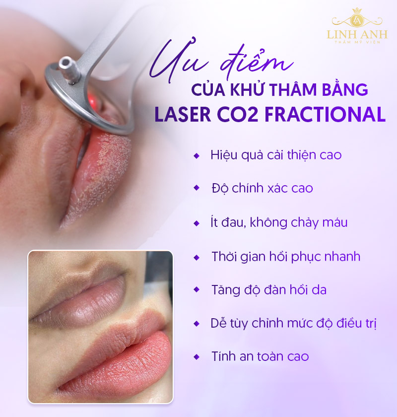 Khử thâm môi bằng Laser CO2