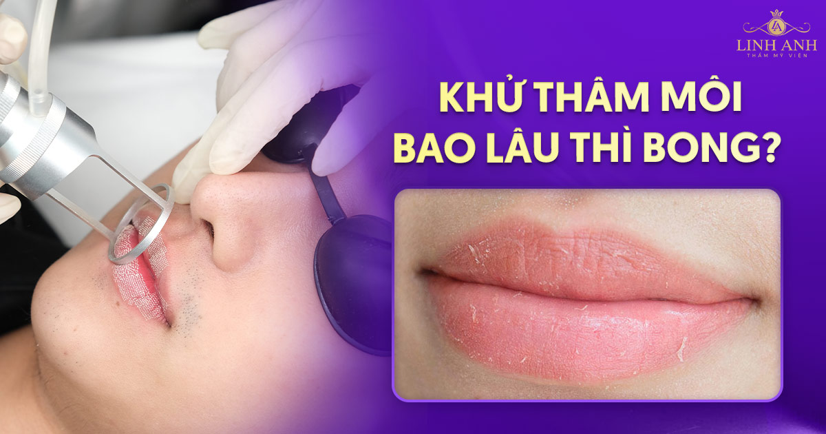 khử thâm môi bao lâu thì bong
