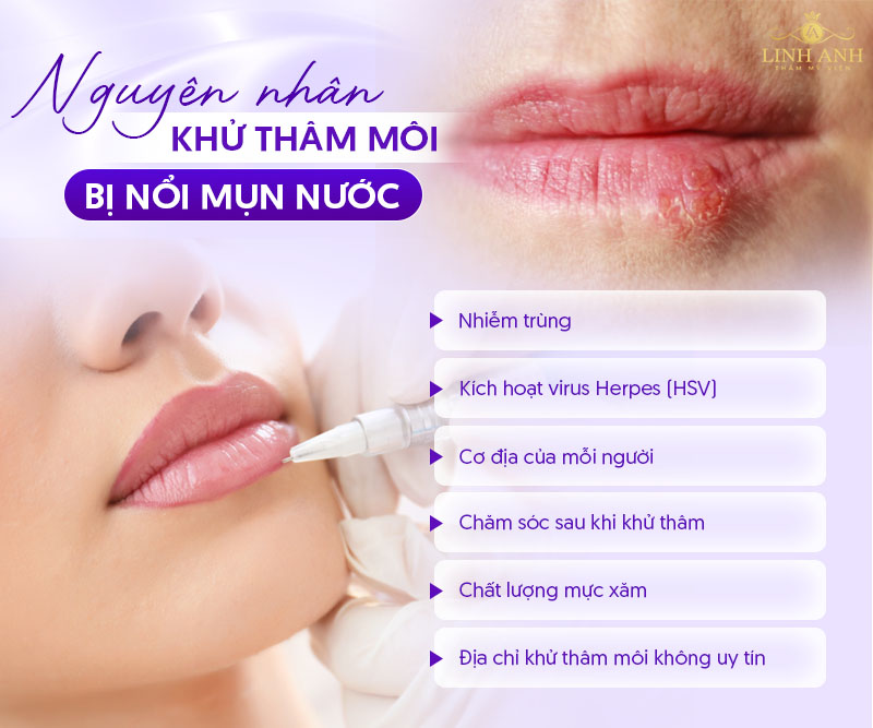 Khử thâm môi bị lên mụn nước Khử thâm môi bị lên mụn nước
