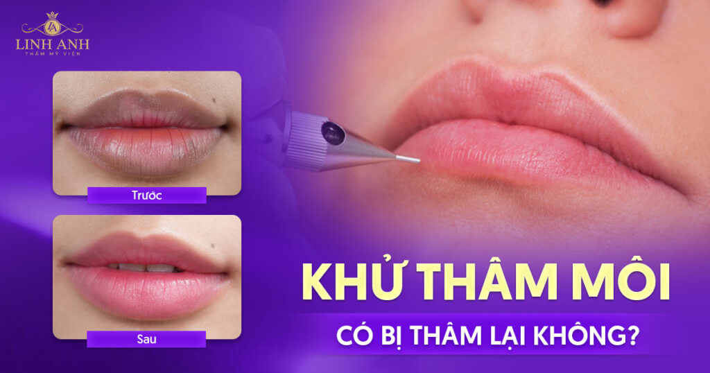 khử thâm môi có bị thâm lại không