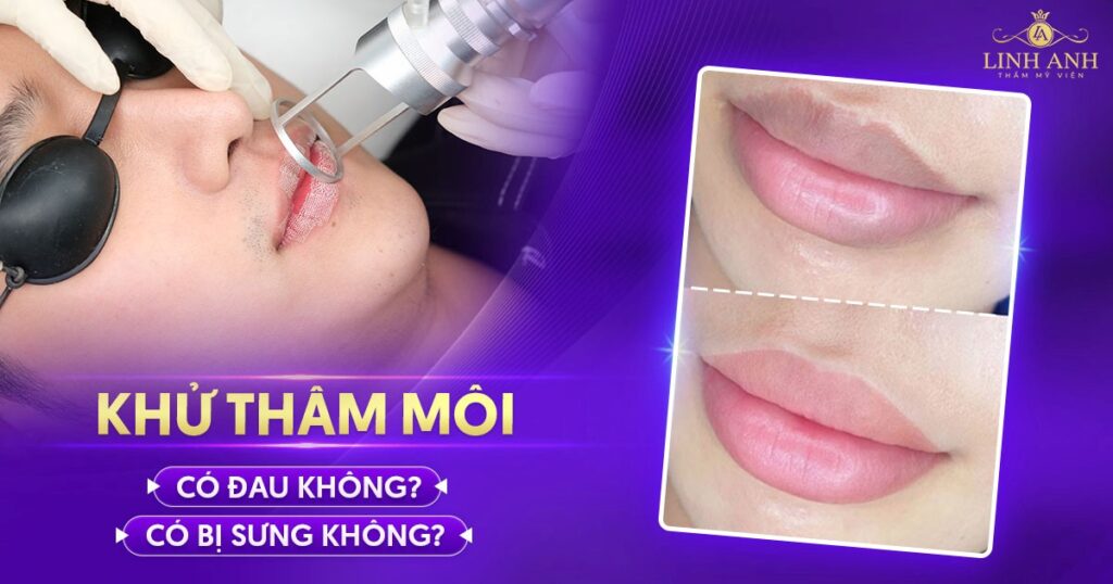 khử thâm môi có đau không