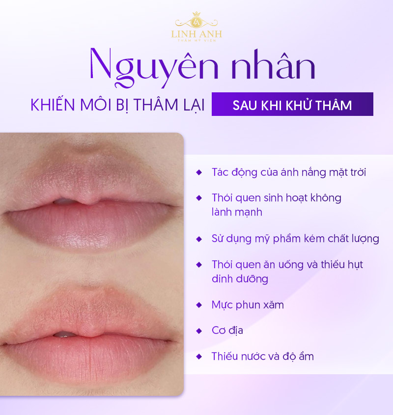 khử thâm môi được bao lâu