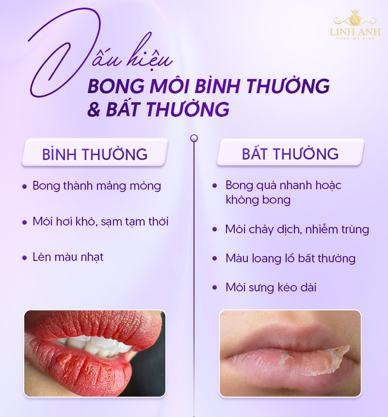 khử thâm môi mấy ngày thì bong khử thâm môi mấy ngày thì bong