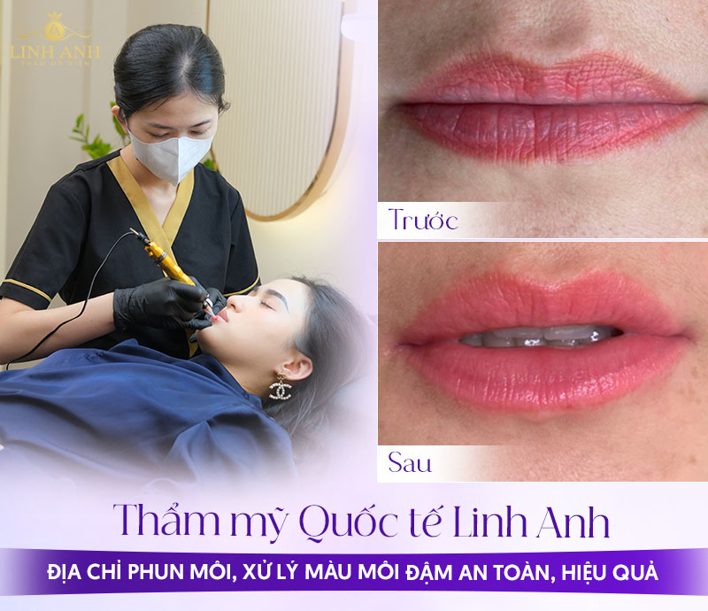 làm gì khi xăm môi lên màu đậm quá làm gì khi xăm môi lên màu đậm quá