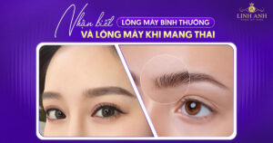 lông mày bình thường và lông mày khi mang thai