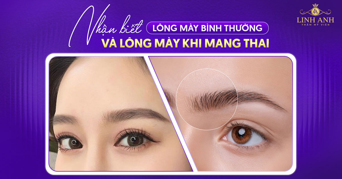 Nhận biết lông mày bình thường và lông mày khi mang thai