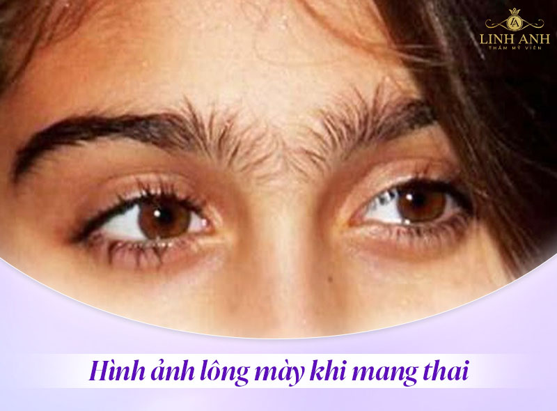 lông mày dựng là dấu hiệu khi mang thai lông mày dựng là dấu hiệu khi mang thai