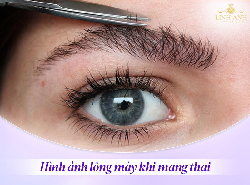 lông mày khi mang thai sẽ ra sao lông mày khi mang thai sẽ ra sao